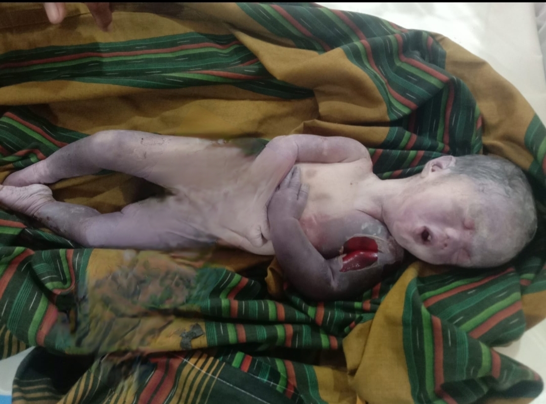 Dugaan Malpraktek Persalinan RS Thalia Irham, Menyebabkan Bayi Meninggal. Sikap Tertutup Direktur, Kuatkan Dugaan.